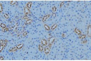 ABIN6279098 at 1/100 staining Mouse kidney tissue by IHC-P. (AGXT2 anticorps  (Internal Region))