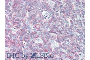 Detection of CD229 in Human Small Intestine Tissue using Polyclonal Antibody to Cluster Of Differentiation 229 (CD229)