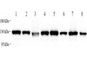 Western blot analysis of KIF5B (ABIN7074440),at dilution of 1: 4000,Lane 1: Mouse heart tissue lysate,Lane 2: Mouse brain tissue lysate,Lane 3: Mouse uterus tissue lysate,Lane 4: Mouse skin tissue lysate,Lane 5: Rat heart tissue lysate,Lane 6: Rat brain tissue lysate,Lane 7: Rat uterus tissue lysate,Lane 8: Rat skin tissue lysate (KIF5B anticorps)