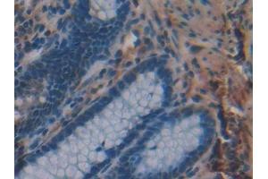 Detection of MPG in Human Rectum Tissue using Polyclonal Antibody to N-Methylpurine DNA Glycosylase (MPG)