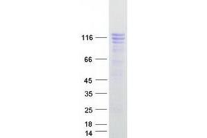 Validation with Western Blot