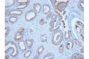 Formalin-fixed, paraffin-embedded human Prostate stained with Pan-Cytokeratin Mouse Monoclonal Antibody (PCK/3150). (KRT anticorps)