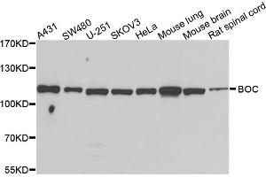 Western blot analysis of extracts of various cell lines, using BOC antibody. (BOC anticorps)