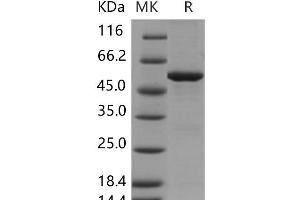 Western Blotting (WB) image for Spastic Paraplegia 21 (SPG21) protein (GST tag,His tag) (ABIN7320147)