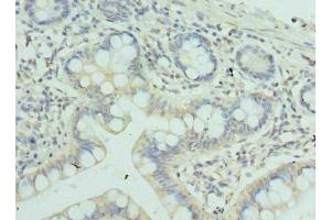 Immunohistochemistry of paraffin-embedded human small intestine tissue using ABIN7176016 at dilution of 1:100