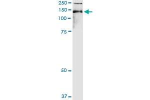 Immunoprecipitation of TIMELESS transfected lysate using anti-TIMELESS MaxPab rabbit polyclonal antibody and Protein A Magnetic Bead , and immunoblotted with TIMELESS purified MaxPab mouse polyclonal antibody (B01P) . (TIMELESS anticorps  (AA 1-1208))