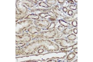 Immunohistochemistry of paraffin-embedded mouse kidney using GLB1 Rabbit pAb (ABIN3015642, ABIN3015643, ABIN3015644 and ABIN6218995) at dilution of 1:100 (40x lens). (GLB1 anticorps  (AA 1-270))