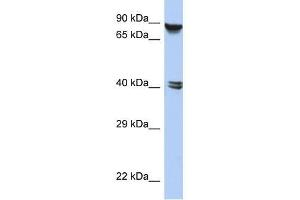 Western Blot showing ZNF429 antibody used at a concentration of 1-2 ug/ml to detect its target protein.
