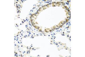 Immunohistochemistry of paraffin-embedded rat lung using BMP5 antibody at dilution of 1:100 (40x lens).