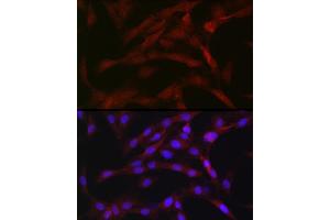 Immunofluorescence analysis of C6 cells using PRKCB Rabbit pAb (ABIN6128462, ABIN6146199, ABIN6146201 and ABIN6217699) at dilution of 1:50 (40x lens).