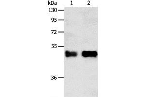 Western Blot analysis of Human liver cancer tissue and A549 cell using SERPINA5 Polyclonal Antibody at dilution of 1:750 (SERPINA5 anticorps)
