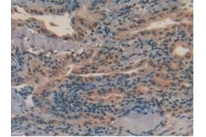 anti-Pro-Platelet Basic Protein (Chemokine (C-X-C Motif) Ligand 7) (PPBP) (AA 59-128) antibody