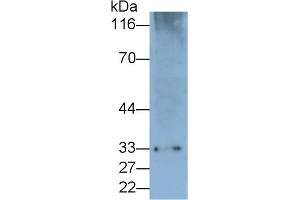 Detection of PD1 in Rat Spleen lysate using Polyclonal Antibody to Programmed Cell Death Protein 1 (PD1) (PD-1 anticorps  (AA 41-132))