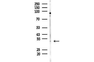 Western blot analysis of lysates from MDA-MB-231 cells(heat-shock,45 min treatment), using HAVCR2 Antibody at 1/1000 dilution.