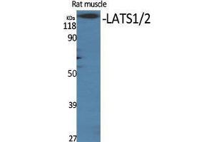 Western Blotting (WB) image for anti-LATS1,2 (Ser116) antibody (ABIN3180713) (LATS1,2 (Ser116) anticorps)