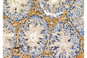 ABIN6263173 and ABIN6273135 at 1/100 staining Mouse testis tissue by IHC-P.