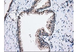 Immunohistochemical staining of paraffin-embedded Human liver tissue using anti-MOBKL1A mouse monoclonal antibody. (MOBKL1A anticorps)