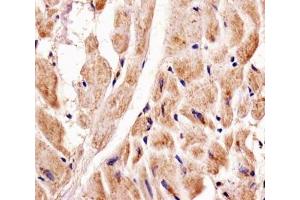 Immunohistochemical analysis of paraffin-embedded human heart using Pink1 antibody at 1:25 dilution.