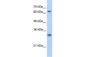 Western Blotting (WB) image for anti-Ubiquitin Specific Peptidase 39 (USP39) antibody (ABIN2461797) (USP39 anticorps)