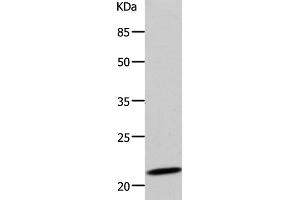 Western Blot analysis of 293T cell using DUT Polyclonal Antibody at dilution of 1:500 (Deoxyuridine Triphosphatase (DUT) anticorps)