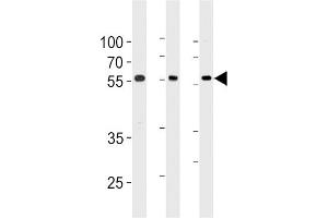 Western blot analysis in 293,A549,Ramos cell line lysates (35ug/lane). (TRIM6 anticorps  (N-Term))