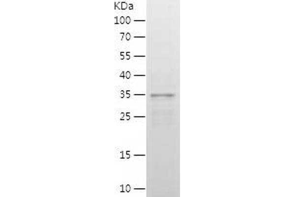 IRF2 Protein (AA 60-349) (His tag)