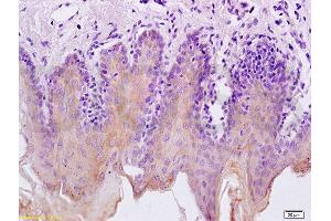 Formalin-fixed and paraffin embedded rat tongue labeled with Anti-pan Cytokeratin Polyclonal Antibody, Unconjugated  at 1:200 followed by conjugation to the secondary antibody and DAB staining.