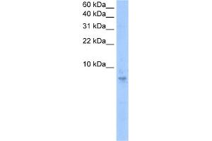 WB Suggested Anti-SEPT6(septin 6) Antibody Titration:  0. (Septin 6 anticorps  (N-Term))