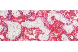 Detection of GH in Human Placenta Tissue using Polyclonal Antibody to Growth Hormone (GH)