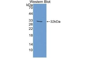 Detection of Recombinant FASN, Rat using Polyclonal Antibody to Fatty Acid Synthase (FASN) (Fatty Acid Synthase anticorps  (AA 2243-2505))