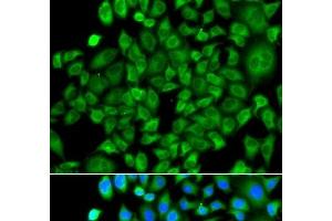 Immunofluorescence analysis of A549 cells using NAA50 Polyclonal Antibody (NAA50 anticorps)