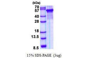 Figure annotation denotes ug of protein loaded and % gel used. (ARSG Protéine)