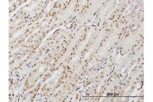 Immunoperoxidase of monoclonal antibody to DDX54 on formalin-fixed paraffin-embedded human stomach.