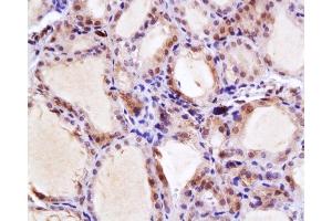 Formalin-fixed and paraffin embedded rat thyroid gland labeled with Anti-NIS Polyclonal Antibody, Unconjugated  at 1:200, followed by conjugation to the secondary antibody and DAB staining