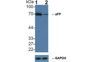Knockout Varification: ;Lane 1: Wild-type HepG2 cell lysate; ;Lane 2: aFP knockout HepG2 cell lysate; ;Predicted MW: 69kDa ;Observed MW: 70kDa;Primary Ab: 2µg/ml Rabbit Anti-Human aFP Ab;Second Ab: 0. (alpha Fetoprotein anticorps  (AA 31-171))