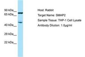 SMAP2 anticorps  (AA 227-276)