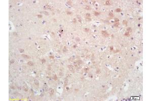 Formalin-fixed and paraffin embedded rat brain labeled with Rabbit Anti GPAM Polyclonal Antibody, Unconjugated (ABIN709121) at 1:200 followed by conjugation to the secondary antibody and DAB staining (GPAM anticorps  (AA 611-710))