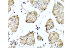 Immunohistochemistry of paraffin-embedded Human stomach using STK3 Polyclonal Antibody at dilution of 1:100 (40x lens).