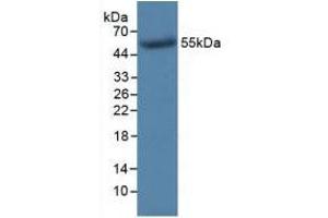 Figure. (TK1 anticorps  (AA 2-234))