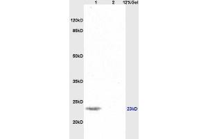 Lane 1: mouse brain lysates Lane 2: human colon carcinoma lysates probed with Anti SNAP25 Polyclonal Antibody, Unconjugated (ABIN738111) at 1:200 in 4 °C. (SNAP25 anticorps  (AA 166-206))