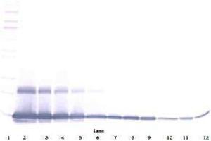Image no. 3 for anti-Chemokine (C-C Motif) Ligand 9 (Ccl9) antibody (ABIN465415) (CCL9 anticorps)