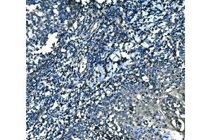 IHC analysis of MEF2B using anti-MEF2B antibody (ABIN7599892).