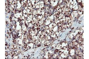 Image no. 6 for anti-serpin Peptidase Inhibitor, Clade B (Ovalbumin), Member 1 (SERPINB1) (AA 77-306) antibody (ABIN1491670)