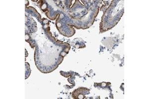 Immunohistochemical staining (Formalin-fixed paraffin-embedded sections) of human duodenum with SFXN5 polyclonal antibody  shows cytoplasmic and membranous positivity in glandular cells at 1:50-1:200 dilution. (Sideroflexin 5 anticorps)