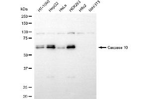 Western blotting analysis using caspase 10 antibody (ABIN7797887).