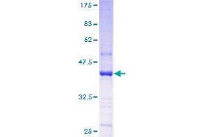 Image no. 1 for Trimethylguanosine Synthase 1 (TGS1) (AA 1-141) protein (GST tag) (ABIN1322650)