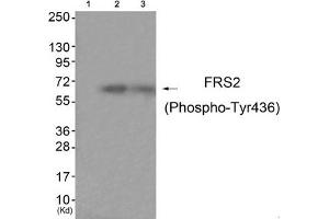 Western blot analysis of extracts from HuvEc cells (Lane 2) and JK cells (Lane 3), using FRS2 (Phospho-Tyr436) Antibody. (FRS2 anticorps  (pTyr436))
