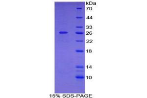 SDS-PAGE analysis of Human Filamin C gamma Protein. (FLNC Protéine)