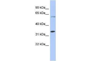 WB Suggested Anti-ZNF8 Antibody Titration:  0. (ZNF8 anticorps  (N-Term))