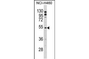 Western blot analysis of BLNK Antibody in NCI-H460 cell line lysates (35ug/lane) (B-Cell Linker anticorps  (AA 150-178))